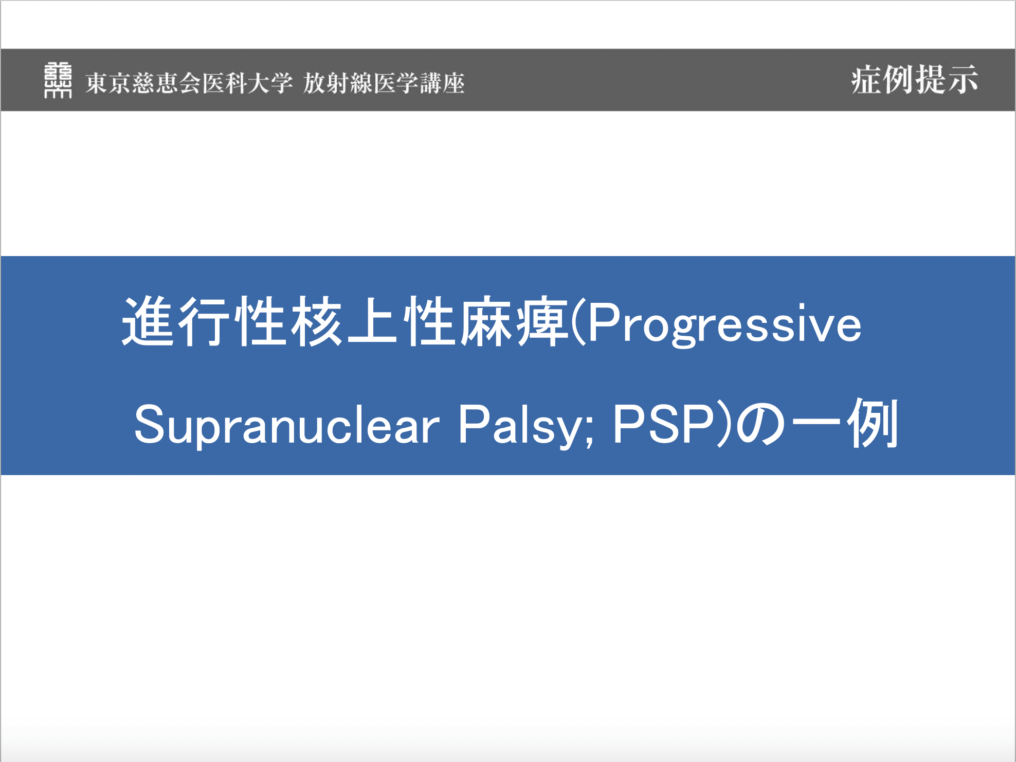 進行性核上性麻痺(Progressive Supranuclear Palsy; PSP)の一例