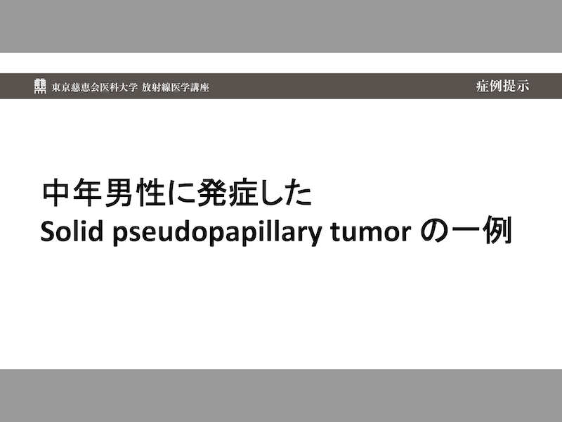 中年男性に発症したSolid pseudopapillary tumor の一例