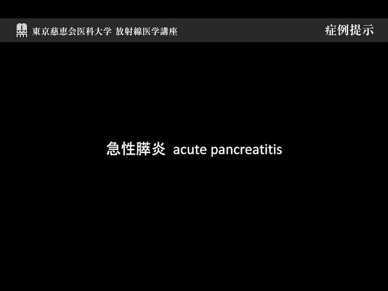 急性膵炎 acute pancreatitis