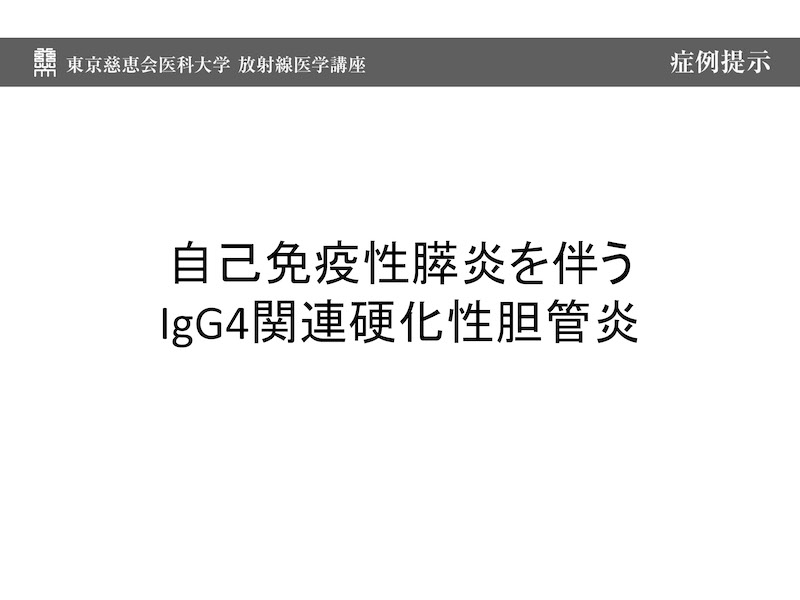 自己免疫性膵炎を伴う IgG4関連硬化性胆管炎
