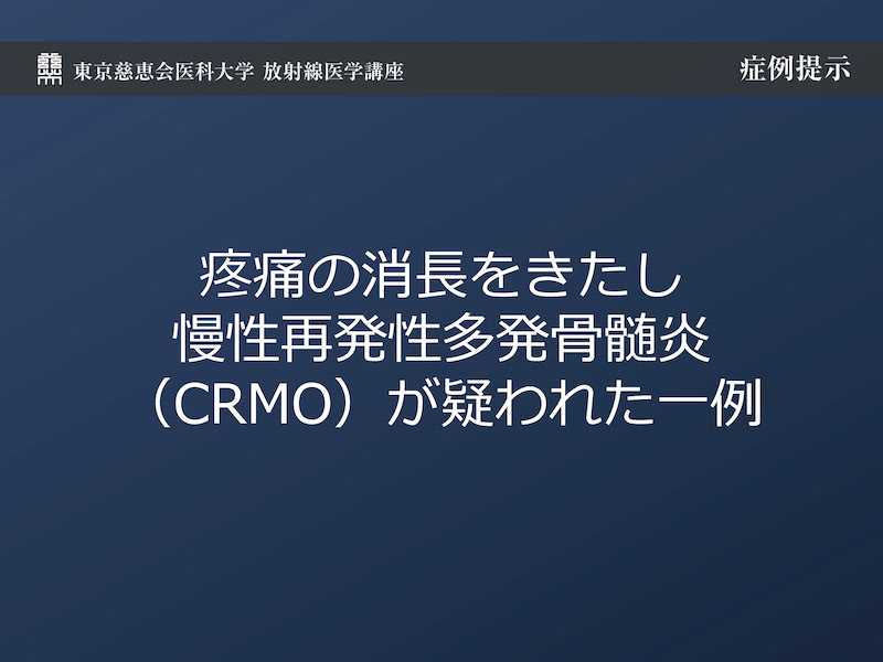 疼痛の消長をきたし慢性再発性多発骨髄炎（CRMO）が疑われた一例