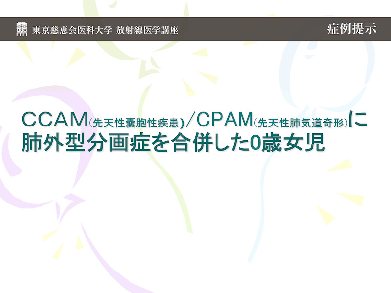 ＣＣＡＭ(先天性嚢胞性疾患)/CPAM(先天性肺気道奇形)に肺外型分画症を合併した0歳女児