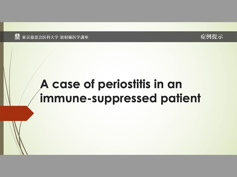 A case of periostitis in an immune-suppressed patient